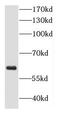 Diacylglycerol Kinase Epsilon antibody, FNab02358, FineTest, Western Blot image 