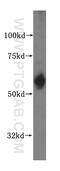 Serine dehydratase-like antibody, 16242-1-AP, Proteintech Group, Western Blot image 