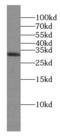 Kallikrein Related Peptidase 8 antibody, FNab04460, FineTest, Western Blot image 