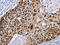 MAGE Family Member A10 antibody, CSB-PA216191, Cusabio, Immunohistochemistry paraffin image 