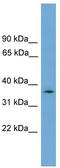 Cytosolic Fe-S cluster assembly factor NUBP1 antibody, TA337665, Origene, Western Blot image 