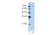 Pre-MRNA Processing Factor 3 antibody, PA5-41795, Invitrogen Antibodies, Western Blot image 
