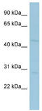 MAGE Family Member A10 antibody, TA346249, Origene, Western Blot image 
