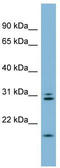 Anaphase-promoting complex subunit 10 antibody, TA329846, Origene, Western Blot image 
