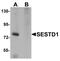SEC14 And Spectrin Domain Containing 1 antibody, NBP1-76279, Novus Biologicals, Western Blot image 