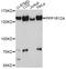 Protein Phosphatase 1 Regulatory Subunit 12A antibody, LS-C746743, Lifespan Biosciences, Western Blot image 