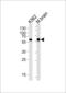 BAI1 Associated Protein 2 antibody, LS-C203924, Lifespan Biosciences, Western Blot image 
