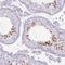 Sperm equatorial segment protein 1 antibody, NBP2-48994, Novus Biologicals, Immunohistochemistry frozen image 