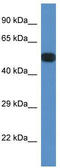 Protein Phosphatase 2 Regulatory Subunit B'Epsilon antibody, TA345141, Origene, Western Blot image 