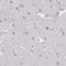 Heparan sulfate 2-O-sulfotransferase 1 antibody, HPA043069, Atlas Antibodies, Immunohistochemistry frozen image 