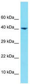 Heterogeneous Nuclear Ribonucleoprotein U Like 1 antibody, TA333898, Origene, Western Blot image 
