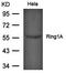 E3 ubiquitin-protein ligase RING1 antibody, orb69602, Biorbyt, Western Blot image 