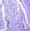 Profilin 2 antibody, PA2162, Boster Biological Technology, Immunohistochemistry paraffin image 