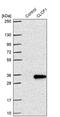 Cardiotrophin-like cytokine factor 1 antibody, PA5-59980, Invitrogen Antibodies, Western Blot image 