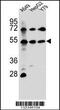 Fibroblast growth factor receptor-like 1 antibody, 56-607, ProSci, Western Blot image 