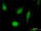 COP9 Signalosome Subunit 2 antibody, H00009318-M02, Novus Biologicals, Immunocytochemistry image 