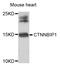 Catenin Beta Interacting Protein 1 antibody, abx006428, Abbexa, Western Blot image 