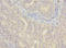 VHL Like antibody, A65646-100, Epigentek, Immunohistochemistry paraffin image 