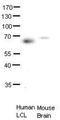 Protein C-ets-2 antibody, TA343521, Origene, Western Blot image 