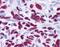 GLI Family Zinc Finger 3 antibody, AHP1456, Bio-Rad (formerly AbD Serotec) , Western Blot image 