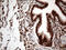 Cyclin Dependent Kinase 15 antibody, M12753, Boster Biological Technology, Immunohistochemistry paraffin image 