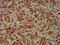 Dystrophin antibody, LS-C680391, Lifespan Biosciences, Immunohistochemistry paraffin image 