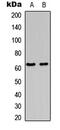 Fos Proto-Oncogene, AP-1 Transcription Factor Subunit antibody, abx121465, Abbexa, Western Blot image 