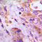 Ribosomal Protein Lateral Stalk Subunit P2 antibody, LS-C358293, Lifespan Biosciences, Immunohistochemistry paraffin image 