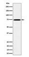 TATA-binding protein-associated factor 2N antibody, M03567-1, Boster Biological Technology, Western Blot image 