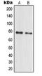 U3 small nucleolar ribonucleoprotein protein MPP10 antibody, LS-C353230, Lifespan Biosciences, Western Blot image 