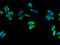 SPG11 Vesicle Trafficking Associated, Spatacsin antibody, A66706-100, Epigentek, Immunofluorescence image 