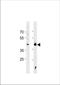 Heat shock factor protein 1 antibody, TA324718, Origene, Western Blot image 