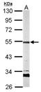 AP2M1 antibody, NBP2-15418, Novus Biologicals, Western Blot image 