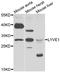 Lymphatic Vessel Endothelial Hyaluronan Receptor 1 antibody, STJ28535, St John