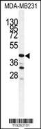 Cathepsin S antibody, 62-868, ProSci, Western Blot image 