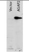 Arf-GAP with GTPase, ANK repeat and PH domain-containing protein 2 antibody, orb86580, Biorbyt, Western Blot image 