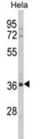 MyoD Family Inhibitor Domain Containing antibody, AP18113PU-N, Origene, Western Blot image 