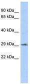 Distal-Less Homeobox 1 antibody, TA345607, Origene, Western Blot image 