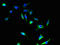 Sideroflexin 4 antibody, LS-C399145, Lifespan Biosciences, Immunofluorescence image 