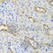Hexokinase 3 antibody, A8428, ABclonal Technology, Immunohistochemistry paraffin image 