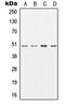 AP2M1 antibody, LS-C352015, Lifespan Biosciences, Western Blot image 