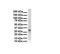 Enoyl-CoA Hydratase Domain Containing 2 antibody, GTX46185, GeneTex, Western Blot image 