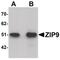 Solute Carrier Family 39 Member 9 antibody, PA5-21074, Invitrogen Antibodies, Western Blot image 