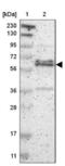 Zinc Finger Protein 135 antibody, NBP1-80913, Novus Biologicals, Western Blot image 