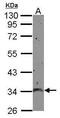Mitochondrial Calcium Uniporter Regulator 1 antibody, PA5-32164, Invitrogen Antibodies, Western Blot image 