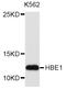 Hemoglobin Subunit Epsilon 1 antibody, orb373173, Biorbyt, Western Blot image 