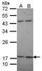 Potassium Calcium-Activated Channel Subfamily M Regulatory Beta Subunit 1 antibody, GTX105666, GeneTex, Western Blot image 