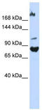 F-Box Protein 11 antibody, TA330471, Origene, Western Blot image 