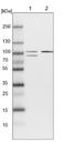 DLG Associated Protein 2 antibody, NBP1-90602, Novus Biologicals, Western Blot image 