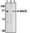 Beta-Secretase 1 antibody, MBS395443, MyBioSource, Western Blot image 